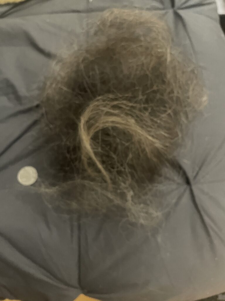 Hair torn from Hannah Foster's head in the attack
